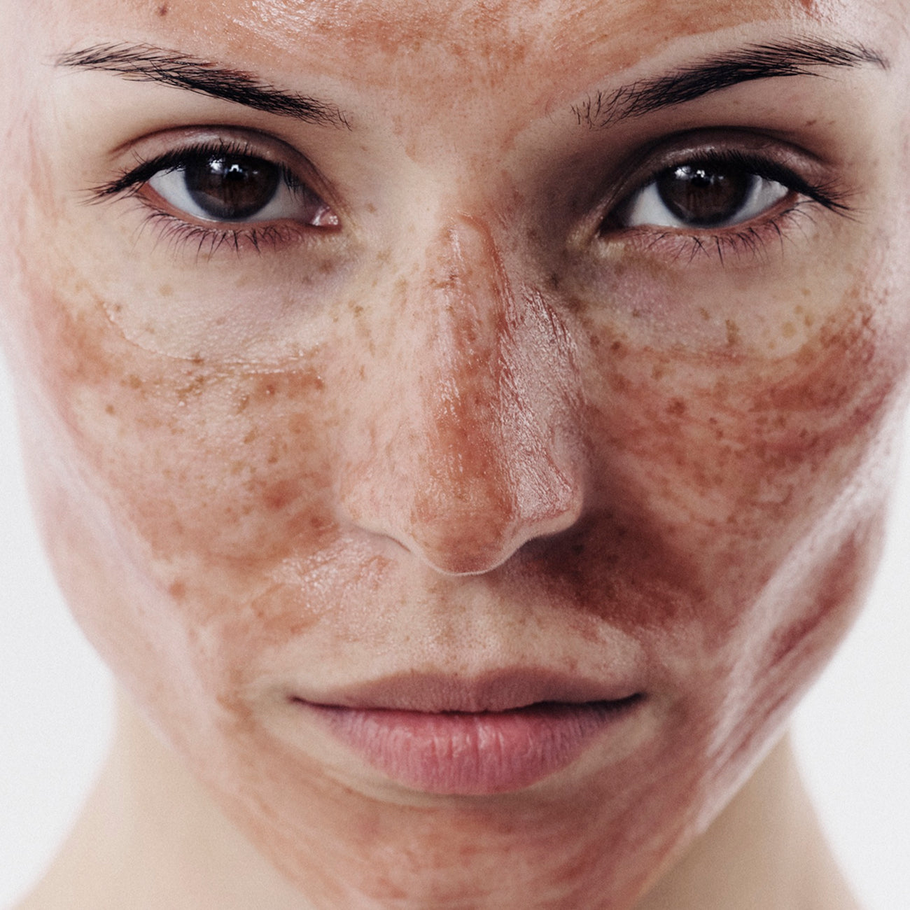 Pore Perfection